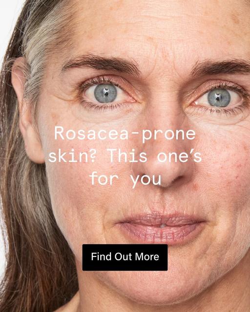 Rosacea